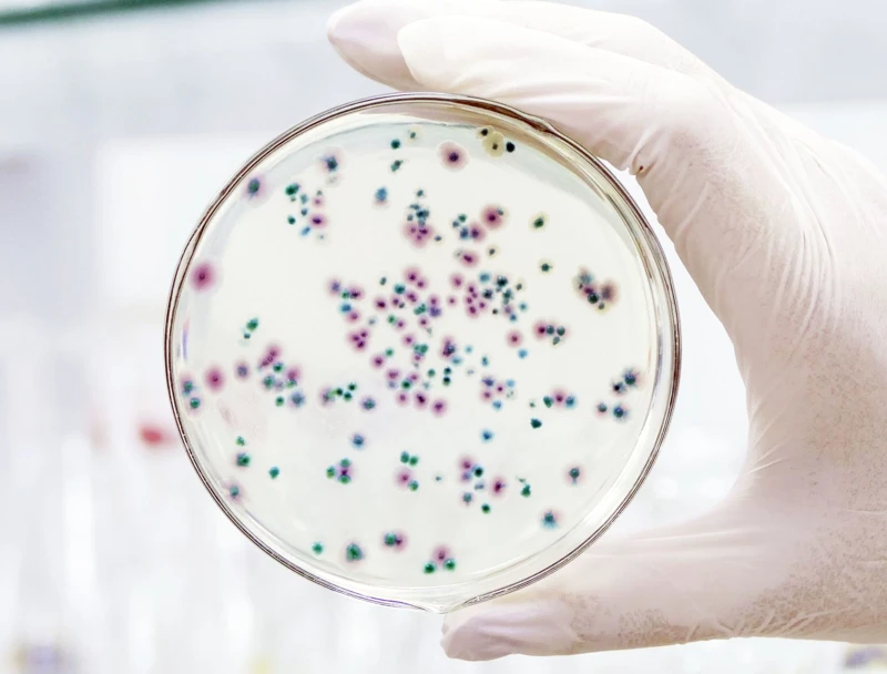  Kiểm soát hiệu quả khuẩn hại Vibrio Para trong ao nuôi tôm bằng AmBio và AnTi Vib