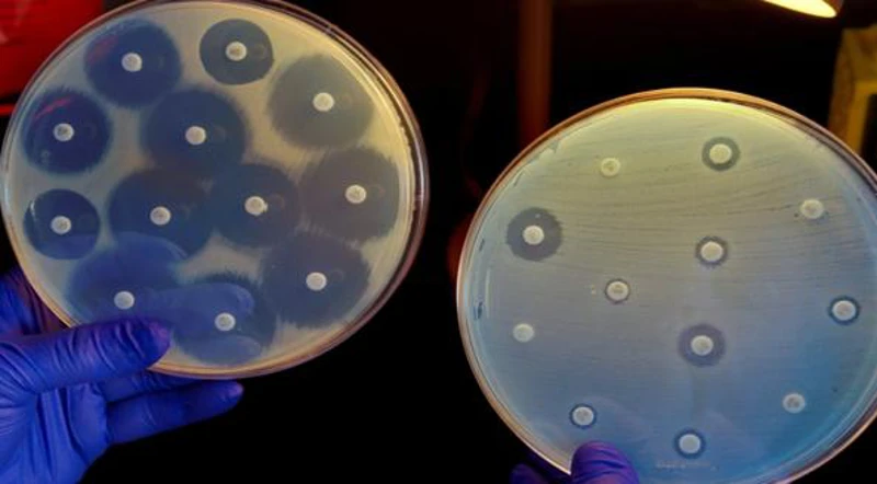 CÁC GIẢI PHÁP HIỆN TẠI KHI ĐIỀU TRỊ BỆNH GAN TỤY TRÊN TÔM