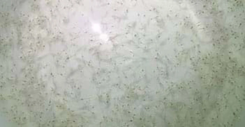 "KIỂM TRA CHẤT LƯỢNG TÔM GIỐNG" VẤN ĐỀ CẦN QUAN TÂM